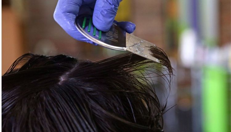 Expert Lice Removal Services In Brooklyn For Safe And Effective Treatment